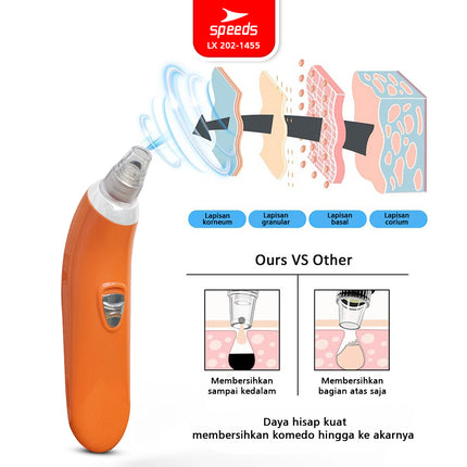 SPEEDS BlackHeads Remover Alat Penyedot Komedo Pembersih Jerawat Wajah Vacuum Cleaner Elektrik 202-1455